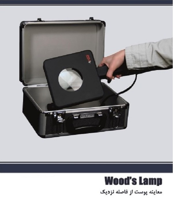 وود لامپ (Wood Lamp) | دستگاه تشخیص پوست با نور UV برای آکنه، قارچ و لک ..